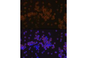 Immunofluorescence analysis of Raw 264 7 cells using PLC gamma 2 (PLC gamma 2 (PLCG2)) Rabbit mAb (ABIN7269342) at dilution of 1:100 (40x lens).