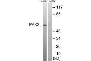 Western blot analysis of extracts from HepG2 cells, treated with serum (20 % , 15 mins), using PAK2 (Ab-192) antibody.