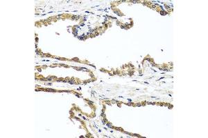 Immunohistochemistry of paraffin-embedded human prostate using OGFR antibody (ABIN5974255) at dilution of 1/100 (40x lens). (OGFR 抗体)