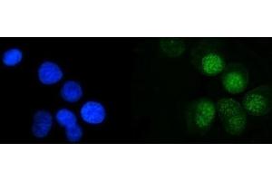 IF analysis of MRE11 using anti-MRE11 antibody (ABIN7600025).