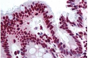 Human Colon (formalin-fixed, paraffin-embedded) stained with THRAP3 antibody ABIN290234 at 10 ug/ml followed by biotinylated goat anti-rabbit IgG secondary antibody ABIN481713, alkaline phosphatase-streptavidin and chromogen. (THRAP3 抗体  (AA 930-955))