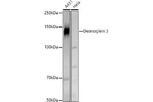 Western blot analysis of extracts of various cell lines, using Desmoglein 3 antibody (ABIN6127804, ABIN6139833, ABIN6139834 and ABIN6224465) at 1:500 dilution. (Desmoglein 3 抗体  (AA 749-999))