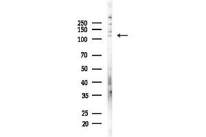 Western blot analysis of lysates from PC12 cells(starvation,24h treatment), using RAS Antibody at 1/1000 dilution.