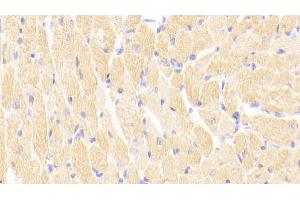 Detection of cTnI in Mouse Cardiac Muscle Tissue using Polyclonal Antibody to Cardiac Troponin I (cTnI) (TNNI3 抗体  (AA 1-211))
