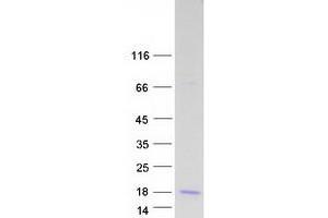 Validation with Western Blot