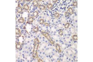 Immunohistochemistry (Paraffin-embedded Sections) (IHC (p)) image for anti-Kelch-Like ECH-Associated Protein 1 (KEAP1) (AA 325-624) antibody (ABIN3022609)