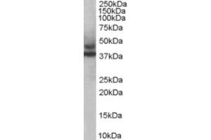 Western Blotting (WB) image for anti-Tripartite Motif Containing 54 (TRIM54) (C-Term) antibody (ABIN2465974) (TRIM54 抗体  (C-Term))