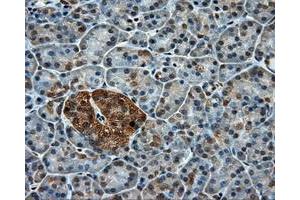 Immunohistochemical staining of paraffin-embedded colon tissue using anti-PPP5C mouse monoclonal antibody. (PP5 抗体)
