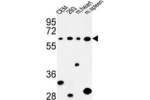 Western Blotting (WB) image for anti-Phospholipase C zeta 1 (PLCz1) antibody (ABIN3004174) (PLCz1 抗体)