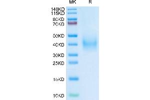 Plasminogen Activator, Urokinase Receptor (PLAUR) (AA 115-305) protein (His tag)