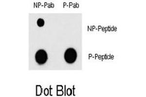 Dot blot analysis of MEF2C (phospho T300) polyclonal antibody  and MEF2C Non Phospho-specific polyclonal antibody on nitrocellulose membrane. (MEF2C 抗体  (pThr300))