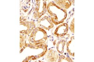 Immunohistochemical analysis of paraffin-embedded H. (HAS2 抗体  (AA 138-166))