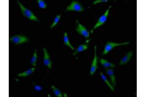 Immunofluorescence (IF) image for anti-Solute Carrier Family 34 (Sodium Phosphate), Member 3 (SLC34A3) (AA 1-76) antibody (ABIN7169994)