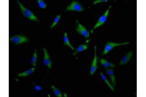 Immunofluorescence staining of Hela cells with ABIN7169994 at 1:100, counter-stained with DAPI. (SLC34A3 抗体  (AA 1-76))