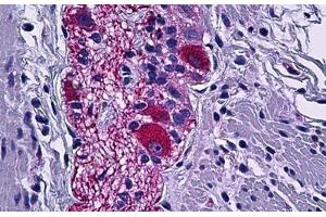 Human Colon, Peripheral Nerve: Formalin-Fixed, Paraffin-Embedded (FFPE) (DPYSL2 抗体  (AA 480-529))