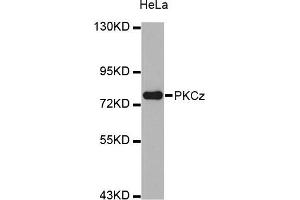 Western blot analysis of extracts of HeLa cell line, using PRKCZ antibody. (PKC zeta 抗体)