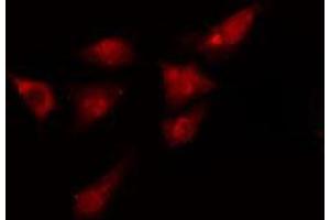 ABIN6275012 staining  HeLa cells by IF/ICC.