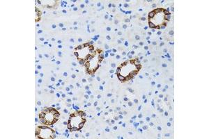 Immunohistochemistry of paraffin-embedded mouse kidney using GABARAP antibody (ABIN6129966, ABIN6140874, ABIN6140877 and ABIN6221250) at dilution of 1:100 (40x lens). (GABARAP 抗体  (AA 1-117))