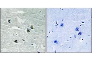 Immunohistochemistry analysis of paraffin-embedded human brain, using MER/SKY (Phospho-Tyr749/681) Antibody. (MER/SKY (AA 716-765), (pTyr749) 抗体)