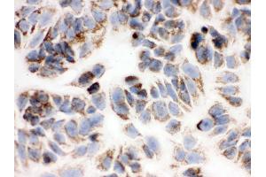 Immunohistochemistry (IHC) image for anti-Peroxiredoxin 3 (PRDX3) (AA 110-256) antibody (ABIN3043904)
