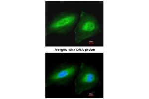 ICC/IF Image Immunofluorescence analysis of paraformaldehyde-fixed HeLa, using CCDC83, antibody at 1:200 dilution. (CCDC83 抗体)