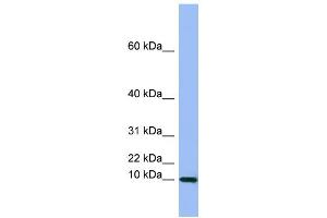 WB Suggested Anti-SEMG1 Antibody Titration:  0. (SEMG1 抗体  (Middle Region))