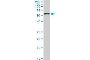 HDAC1 monoclonal antibody (M02), clone 3E1 Western Blot analysis of HDAC1 expression in Hela S3 NE . (HDAC1 抗体  (AA 1-482))