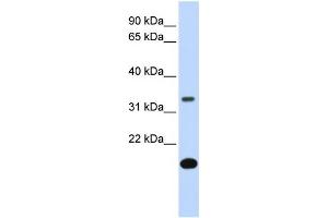 WB Suggested Anti-FST Antibody Titration:  0. (Follistatin 抗体  (Middle Region))
