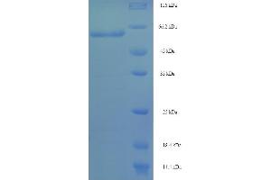 SDS-PAGE (SDS) image for Interferon Regulatory Factor 8 (IRF8) (AA 1-424), (full length) protein (His-SUMO Tag) (ABIN5709767) (IRF8 Protein (AA 1-424, full length) (His-SUMO Tag))