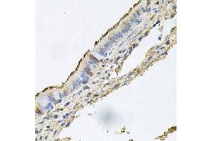 Immunohistochemistry of paraffin-embedded human trachea using DSG1 antibody (ABIN6003544) at dilution of 1/100 (40x lens). (Desmoglein 1 抗体)