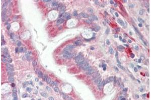 Human Small Intestine: Formalin-Fixed, Paraffin-Embedded (FFPE) (O3FAR1 抗体  (AA 1-71))