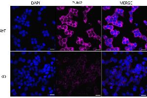 Immunocytochemical staining of HeLa cells using PUM2 antibody (ABIN7800065), 1:1,000), Top panel: wild-type (WT), Bottom panal: PUM2 shRNA knockdown (KD).