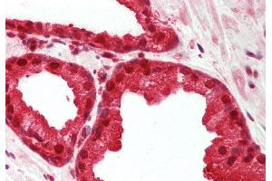 Rabbit Anti-MAT2A antibody Catalog Number: ARP46144 Formalin Fixed Paraffin Embedded Tissue: Human Prostate Primary antibody Concentration: 1:200 Secondary Antibody: Donkey anti-Rabbit-Cy3 Secondary Antibody Concentration: 1:200 Magnification: 20x Exposure Time: 0. (MAT2A 抗体  (Middle Region))