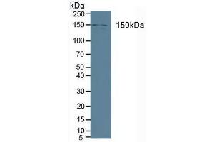 Detection of PLCb3 in Human A431 cells using Polyclonal Antibody to Phospholipase C Beta 3, Phosphoinositide Specific (PLCb3) (Phospholipase C beta 3, Phosphoinositide Specific (AA 318-468) 抗体)