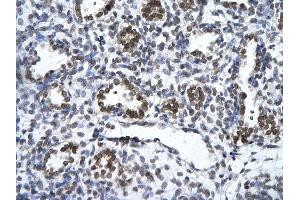 Rabbit Anti-ZNF148 Antibody       Paraffin Embedded Tissue:  Human alveolar cell   Cellular Data:  Epithelial cells of renal tubule  Antibody Concentration:   4. (ZNF148 抗体  (Middle Region))