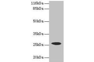 Western blot All lanes: CSHL1 antibody at 2 μg/mL + Human placenta tissue Secondary Goat polyclonal to rabbit IgG at 1/10000 dilution Predicted band size: 26, 23, 16, 15 kDa Observed band size: 26 kDa (CSHL1 抗体  (AA 1-128))