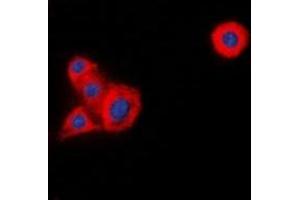 Immunofluorescent analysis of LCK staining in HeLa cells. (LCK 抗体)