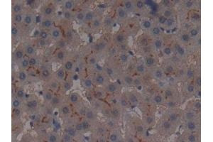 Detection of AAP in Human Liver Tissue using Polyclonal Antibody to Alanine Aminopeptidase (AAP) (ALT 抗体  (AA 581-738))