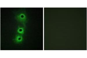 Immunofluorescence analysis of COS7 cells, using CDH8 Antibody. (Cadherin 8 抗体  (AA 491-540))