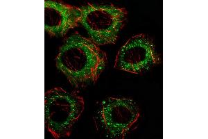Fluorescent image of A549 cell stained with FADS2 Antibody (N-term) (ABIN656230 and ABIN2845545)/SA110322AN. (FADS2 抗体  (N-Term))