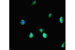 Immunofluorescent analysis of HepG2 cells using ABIN7172403 at dilution of 1: 100 and Alexa Fluor 488-congugated AffiniPure Goat Anti-Rabbit IgG(H+L) (SMARCA4 抗体  (AA 808-1092))