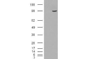 HEK293 overexpressing SMEK1 and probed with ABIN2560023 (mock transfection in first lane). (SMEK1 抗体  (Internal Region))