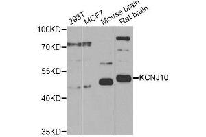 Western blot analysis of extracts of various cell lines, using KCNJ10 Antibody (ABIN6003558) at 1/1000 dilution. (KCNJ10 抗体)