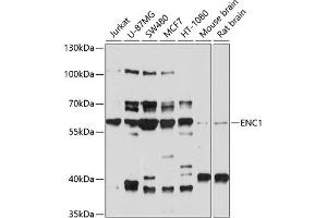 Western blot analysis of extracts of various cell lines, using ENC1 antibody (ABIN6130834, ABIN6140166, ABIN6140167 and ABIN6214438) at 1:1000 dilution. (ENC1 抗体  (AA 1-270))