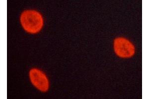 ABIN6269188 staining A549 cells by ICC/IF.