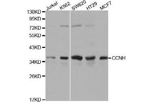 Western blot analysis of extracts of various cell lines, using CCNH antibody. (Cyclin H 抗体  (AA 1-323))