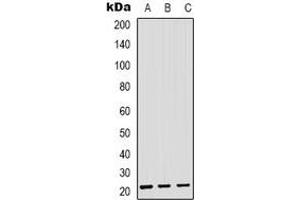 Western blot analysis of SAR1B expression in HEK293T (A), Hela (B), RAW264. (SAR1B 抗体)