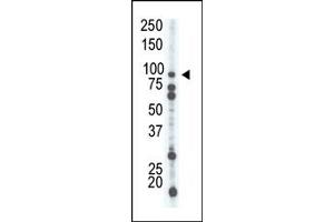 Image no. 1 for anti-phosphofructokinase, Platelet (PFKP) (C-Term) antibody (ABIN360627) (PFKP 抗体  (C-Term))