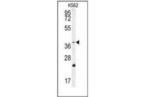 Western Blotting (WB) image for anti-F-Box and WD Repeat Domain Containing 12 (FBXW12) (AA 298-328), (C-Term) antibody (ABIN952293)