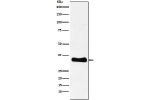 Western blot analysis of Monoacylglycerol Lipase expression in human heart lysate.